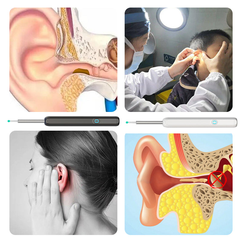 🔥Wi -Fi Visible Wax Elimination Spoon, USB HD Load Otoscope