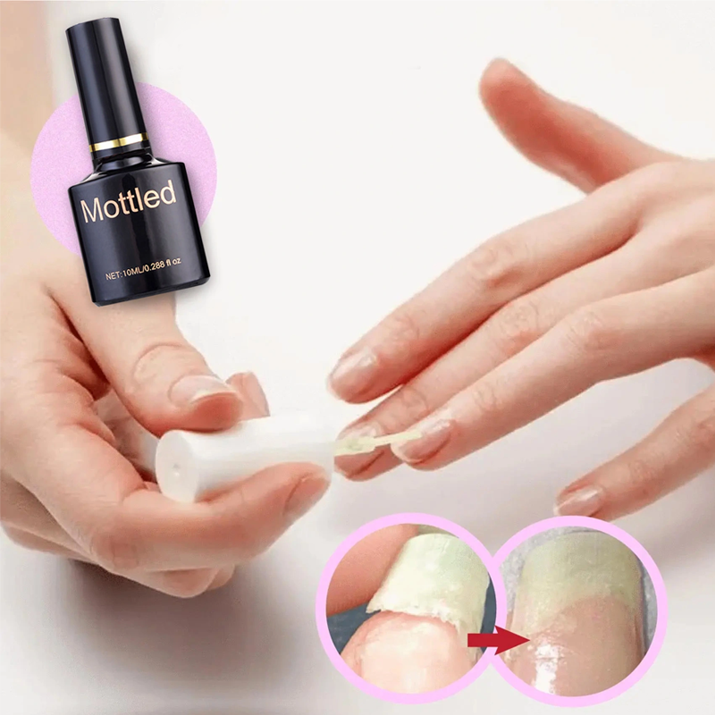 Nail Repair Protection Gel